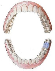 <p>mandibular left second molar</p>