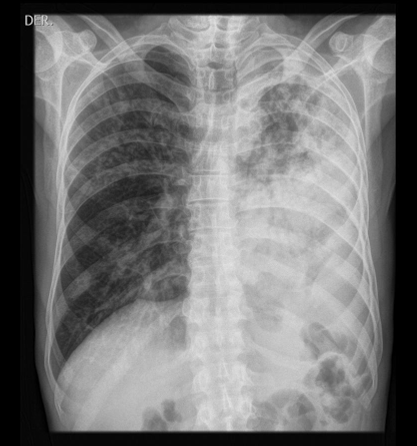 <p>Diagnosis </p>