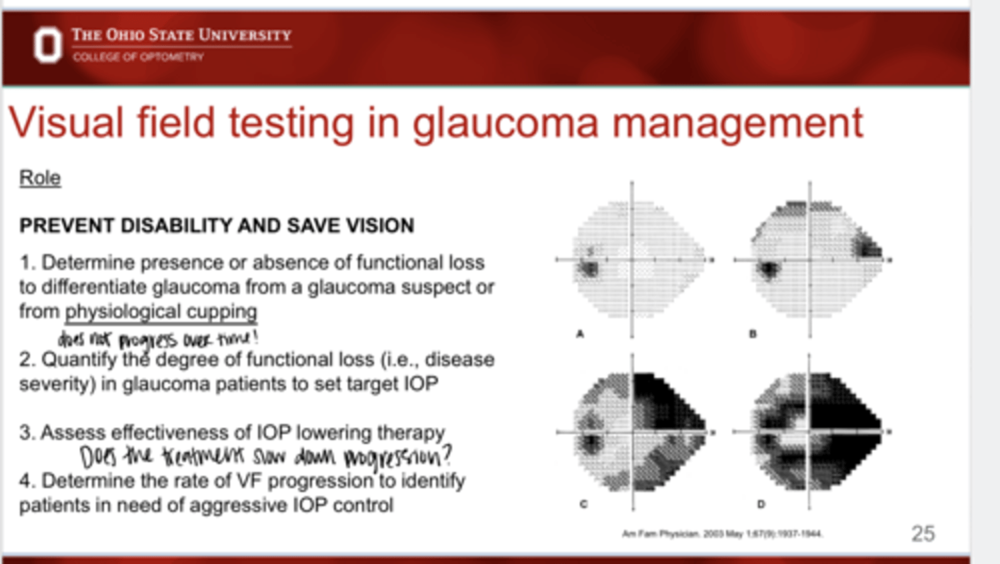 <p>What is the role of VF testing in glaucoma management?</p>