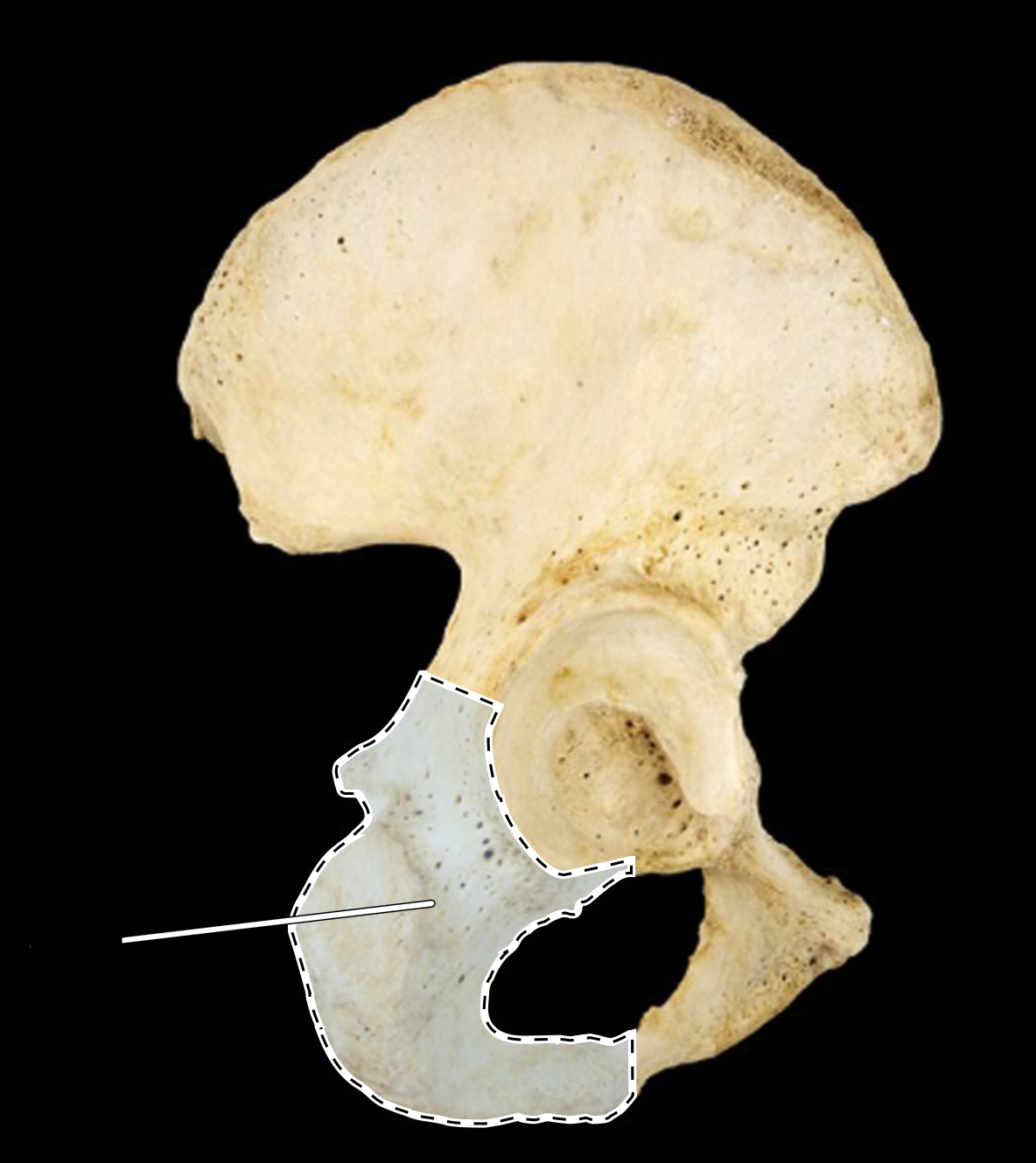 <p>lateral view, right side</p>