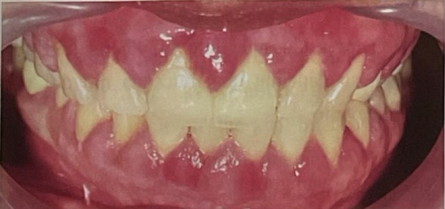 <p>CHẨN ĐOÁN</p>