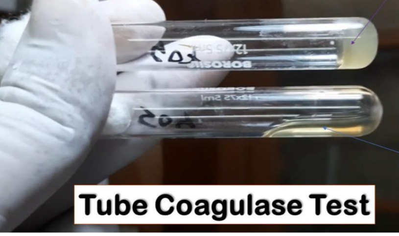 <p>Which tube shows a negative coagulase test? </p>