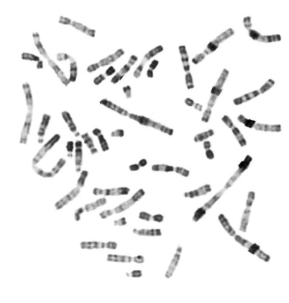 <p>short segmental duplications</p>