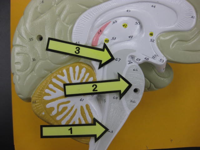 <p>Identify 1, 2, and 3? </p><p>Lab Image 10-6</p>