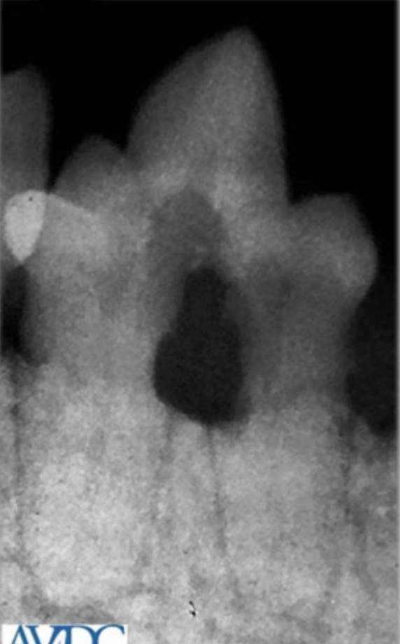 <p>Which tooth resorption stage? What is happening and what should you do?</p>