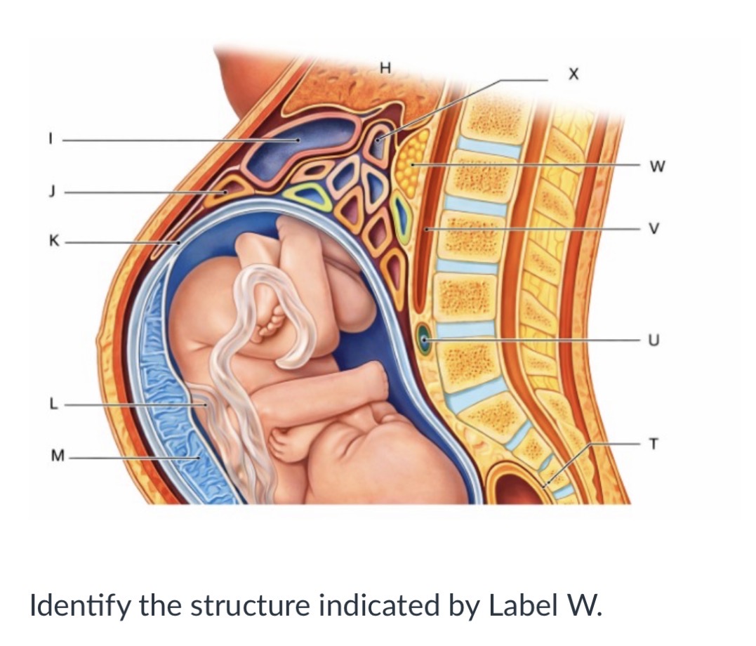 <p>Small intestine</p><p></p><p>Pancreas</p><p>&nbsp;</p><p>Fundus of uterus</p><p>&nbsp;</p><p>Rectum</p>