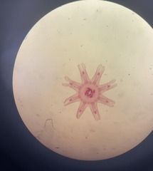 <p>A tiny, free-swimming larval jellyfish released during the asexual strobilation phase of a benthic polyp</p>