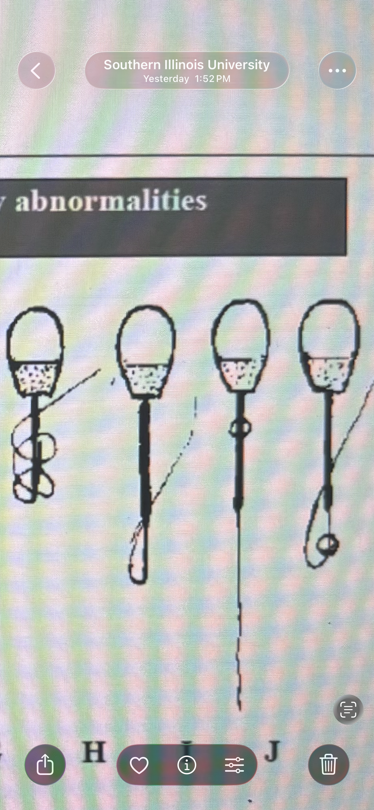 <p>Identify these secondary abnormalities</p>