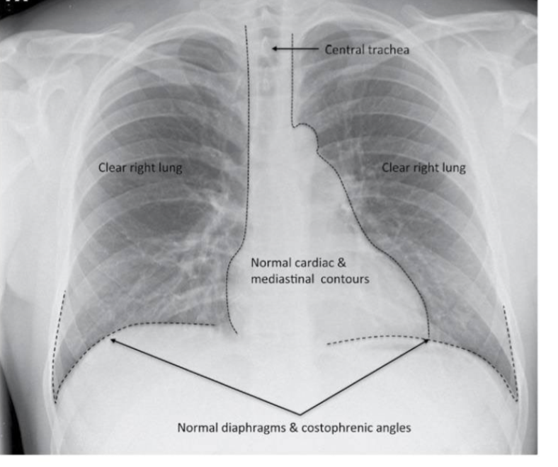 <p>what type of view is shown? </p>