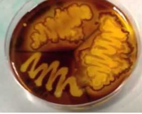 <p>clear zone around growth when reagent added</p>