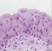 <p>what tissue type and what slide?</p>