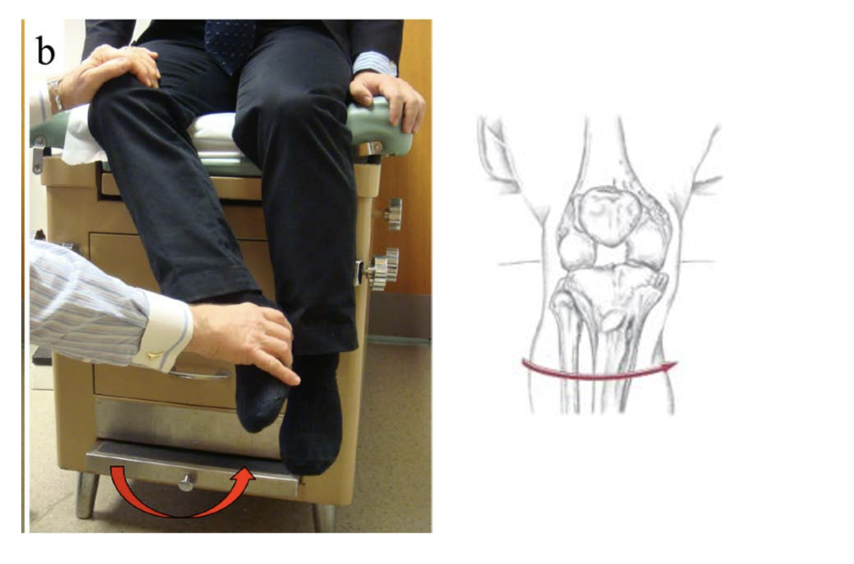 <p><span>Which of the following are the synergists of the motion depicted below? Select all that apply.</span></p>