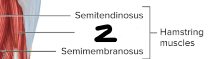 <p>What is #2?</p>
