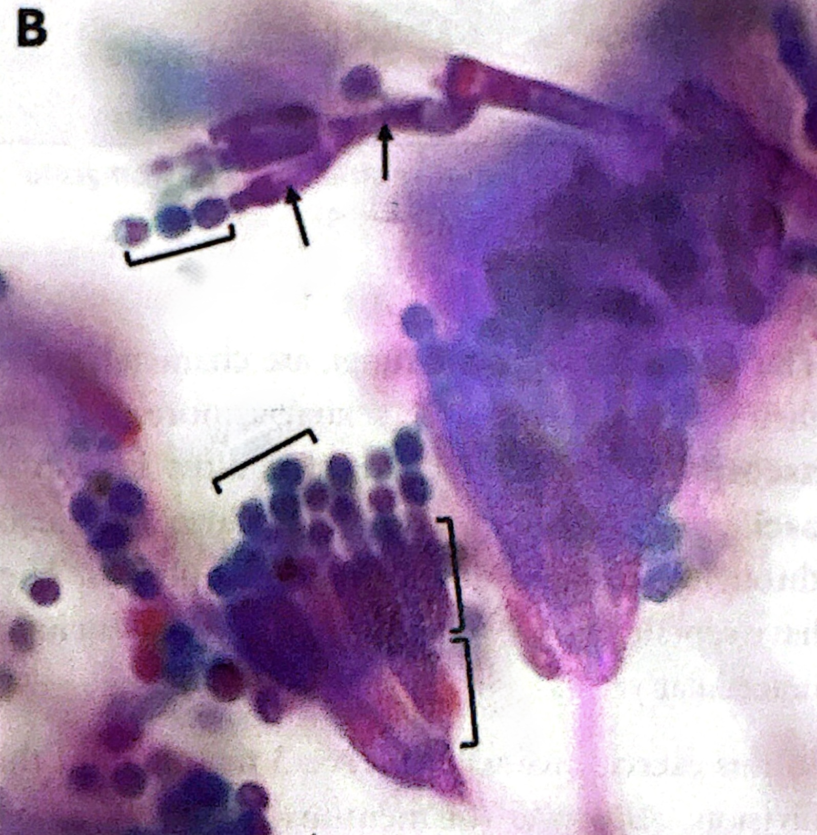 <p>blue-green molds that undergo asexual reproduction through branched conidiophores</p>