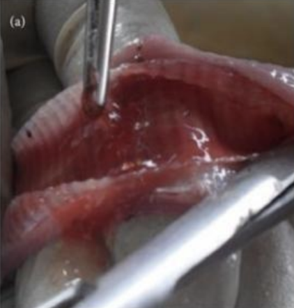 <p>Identify</p><ul><li><p>Lesions:</p></li><li><p>Morphological Diagnosis:</p></li></ul><p></p>