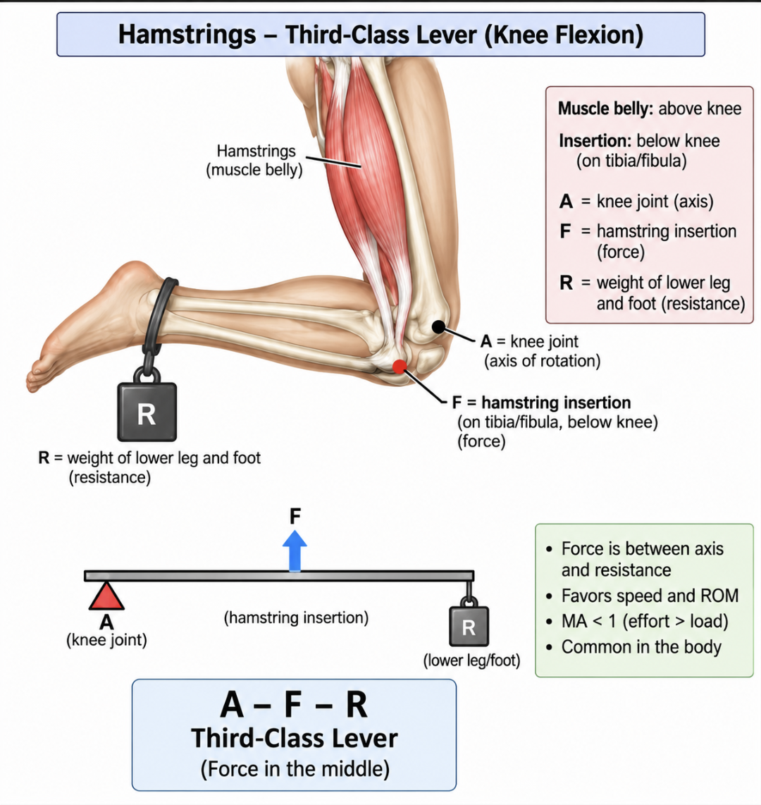 <p>Use the <strong>muscle insertion</strong>, NOT the muscle belly.</p><p>The muscle belly may be on one side of the joint, but <strong>force is applied where the muscle inserts on the bone</strong>.</p><p>Example: <strong>Hamstrings</strong></p><ul><li><p>Muscle belly = posterior thigh</p></li><li><p>Insertion = <strong>below the knee</strong></p></li><li><p>The insertion is where <strong>F (force)</strong> is located.</p></li></ul><p>Think: <strong>Where do the hamstrings PULL the lower leg? → at their insertion below the knee → that is where F goes.</strong></p>