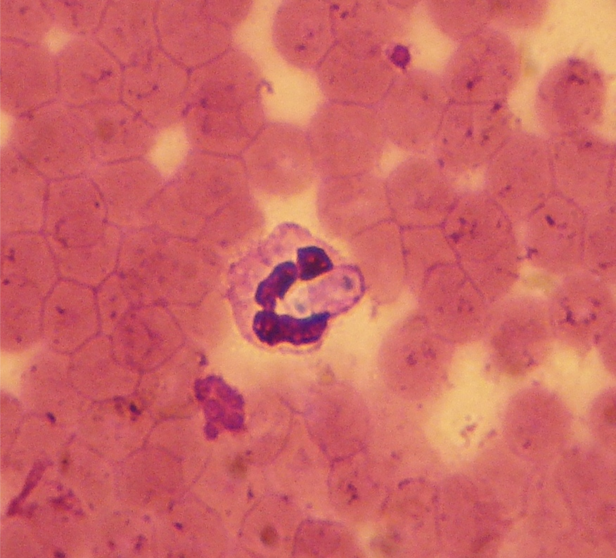 <p>hepatozoon americanum</p>