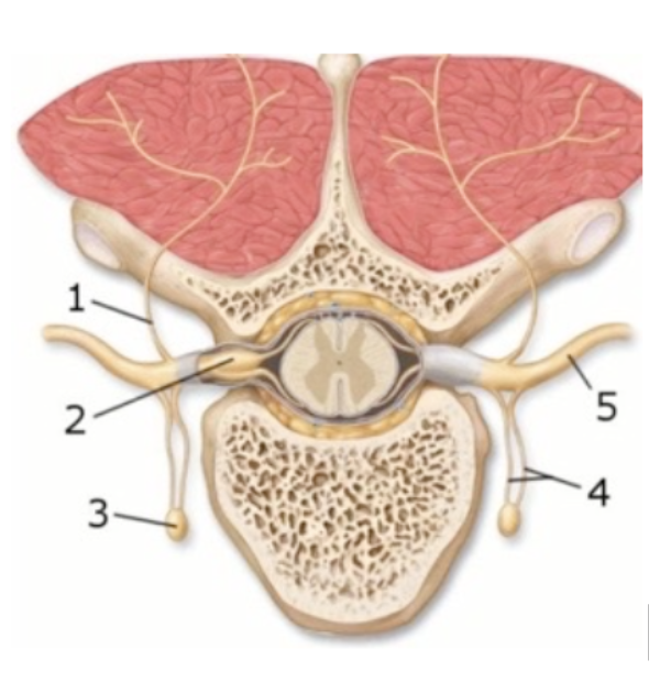 <p><span style="background-color: transparent; font-family: "Times New Roman", serif;"><strong>This figure demonstrates the branches of the spinal nerve. What structure(s) does number 3 indicate?</strong></span></p><p><span style="background-color: transparent; font-family: "Times New Roman", serif;">Dorsal ramus </span></p><p><span style="background-color: transparent; font-family: "Times New Roman", serif;">Dorsal root ganglion </span></p><p><span style="background-color: transparent; font-family: "Times New Roman", serif;">Rami communicans</span></p><p><span style="background-color: transparent; font-family: "Times New Roman", serif;"> Sympathetic trunk ganglion </span></p><p><span style="background-color: transparent; font-family: "Times New Roman", serif;">Ventral ramus</span></p>