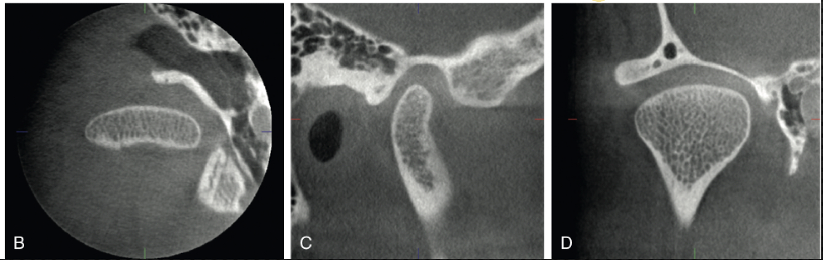 <p>What is image B, C and D examples of?</p>