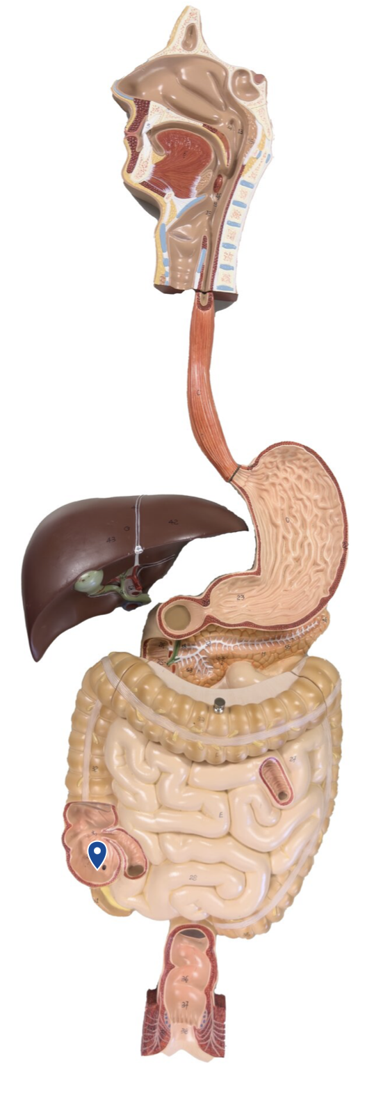<p>Name this segment of the large intestine.</p>