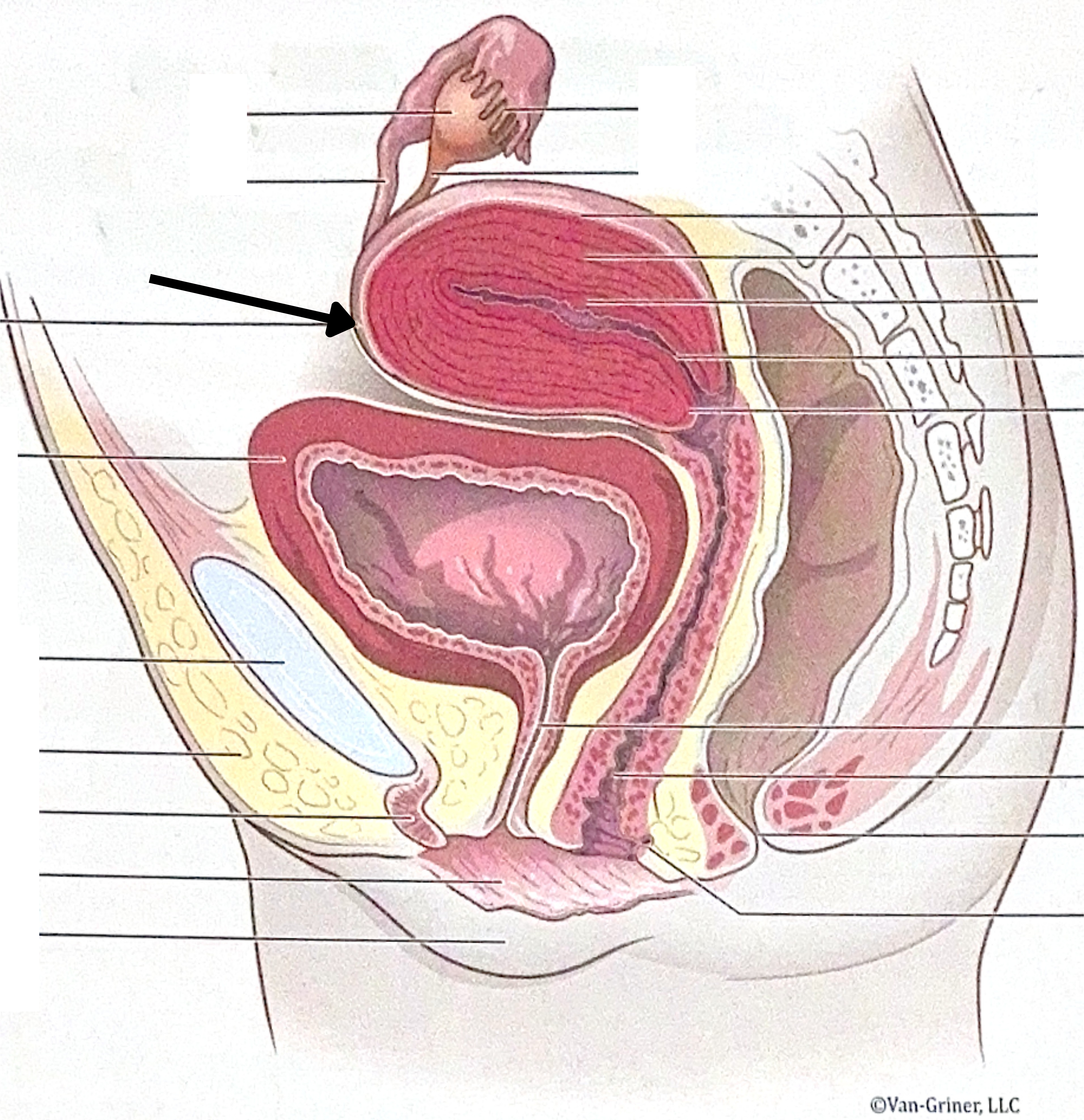 <p>What is the structure indicated in the image?</p>