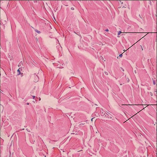 <p>What tissue?</p>