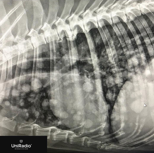 <p>Nodular pattern</p><ul><li><p>With very observable radiopacity nodules</p></li><li><p>Tuberculosis</p></li><li><p>Metastases</p></li><li><p>Pulmonary TB</p></li></ul><p></p>
