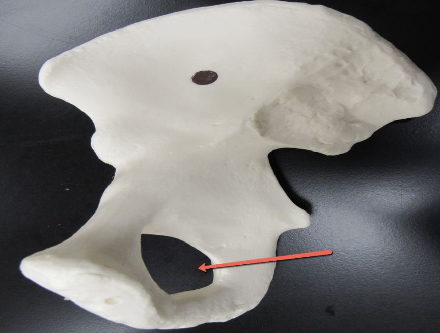 <p><strong>Identify the bone marking indicated by the pointer.</strong></p>