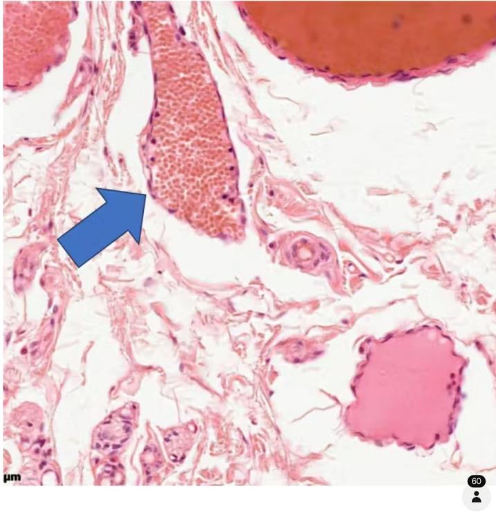 <p>Identify the vessel</p>