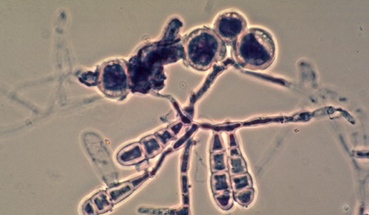 <p>Identify the Fungus</p>