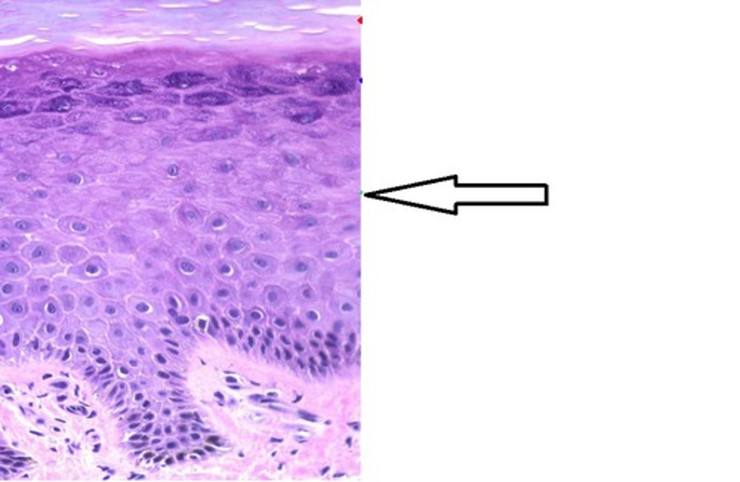 <p>layer of the epidermis superficial to the stratum basale, characterized by the presence of desmosomes</p>