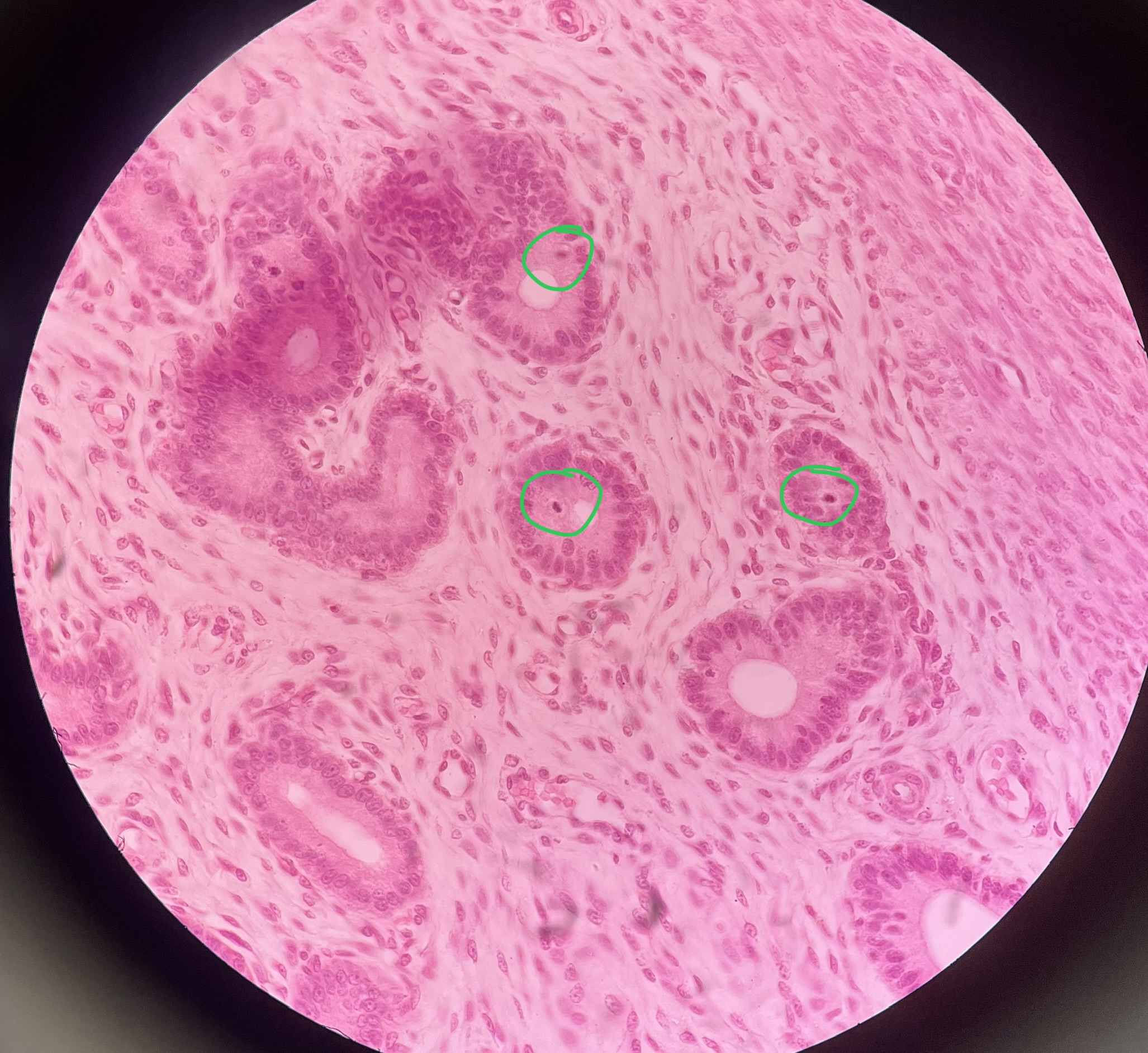 <p>What cell inclusion is circled here?</p>