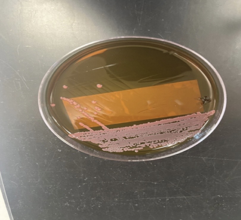 <p>Enterobacter aerogenes</p>