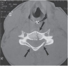 <p>CT Scan</p>