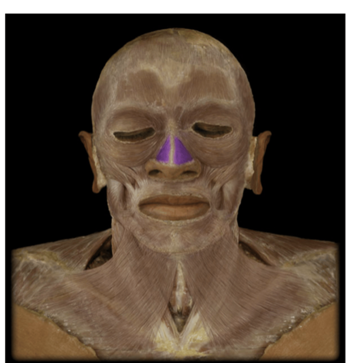 <p>What muscle is indicated in purple?,.</p>