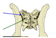 <p>what kind of joint in the sacroiliac joint is indicated by the blue arrow in the caudal area</p>