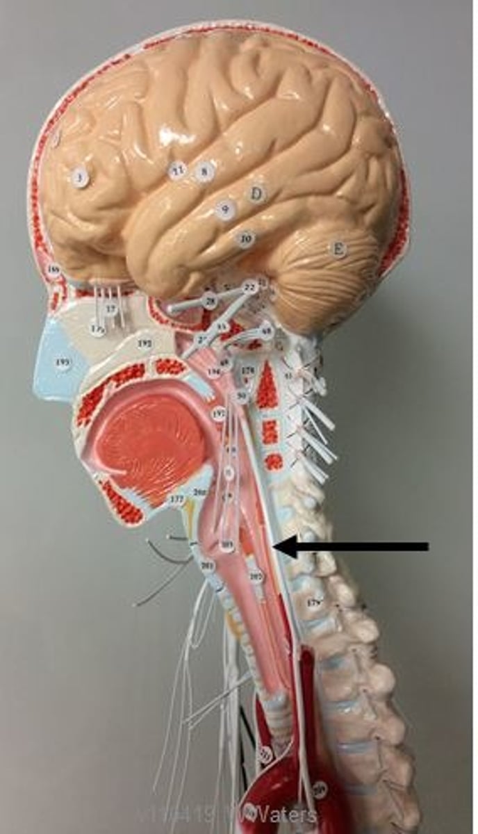 <p>Identify the name and number of this cranial nerve.</p>