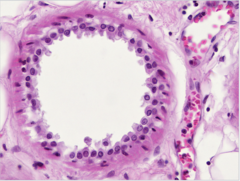 <p>Identify</p>