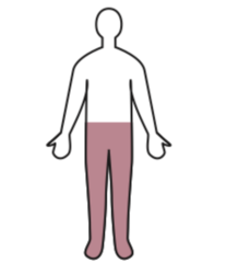 <p>paralysis of the lower half of the body</p>