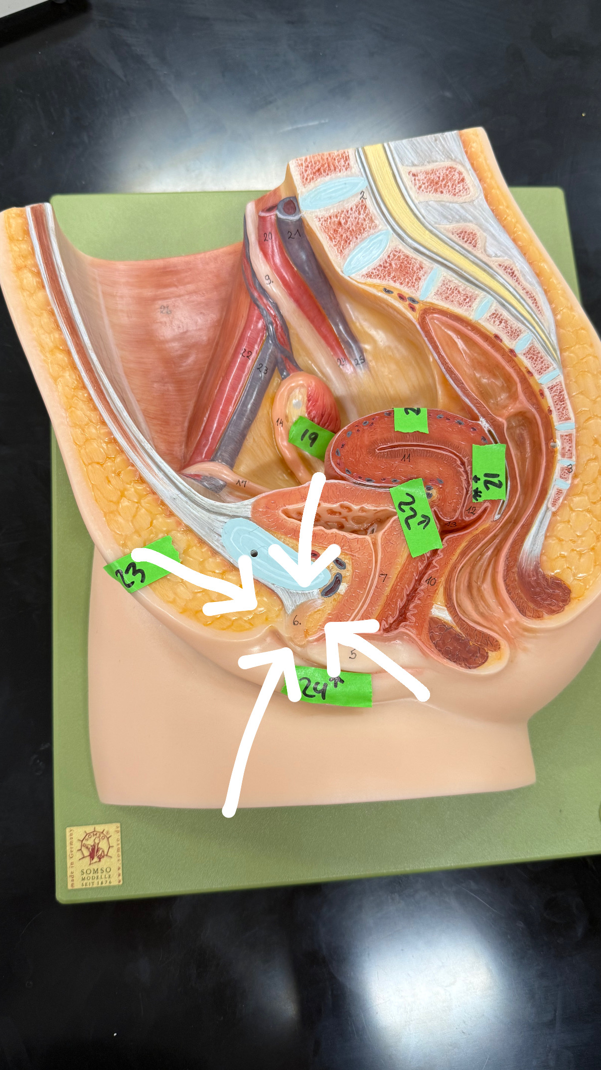 <p>looks like a banana, under the pubic bone</p>