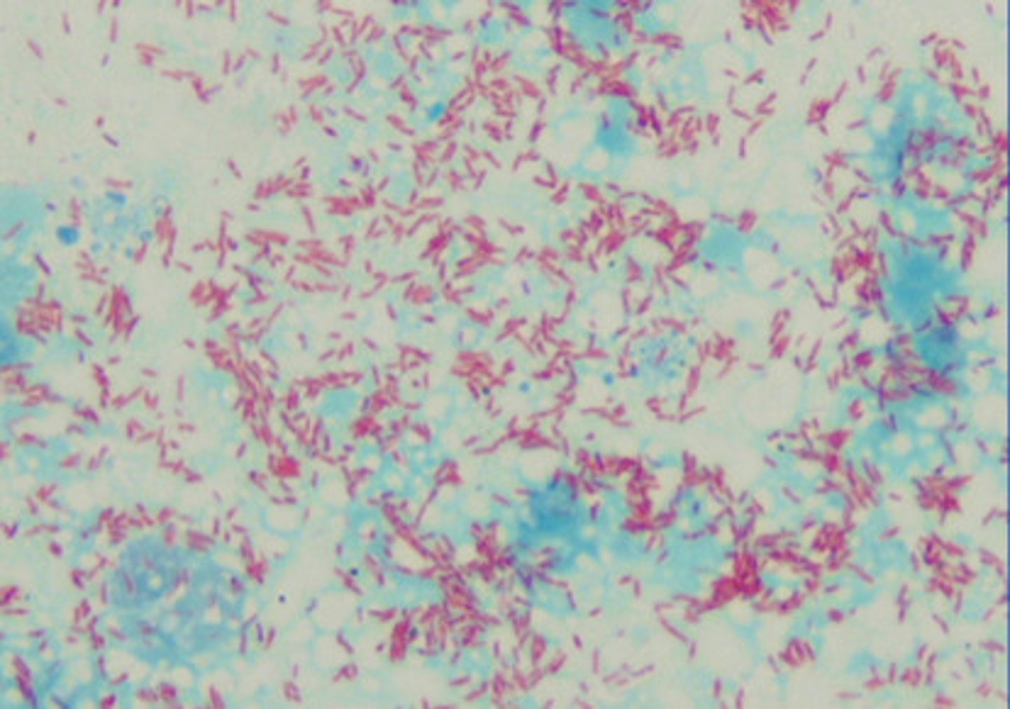 <p>mycolic acids (red stain)</p>