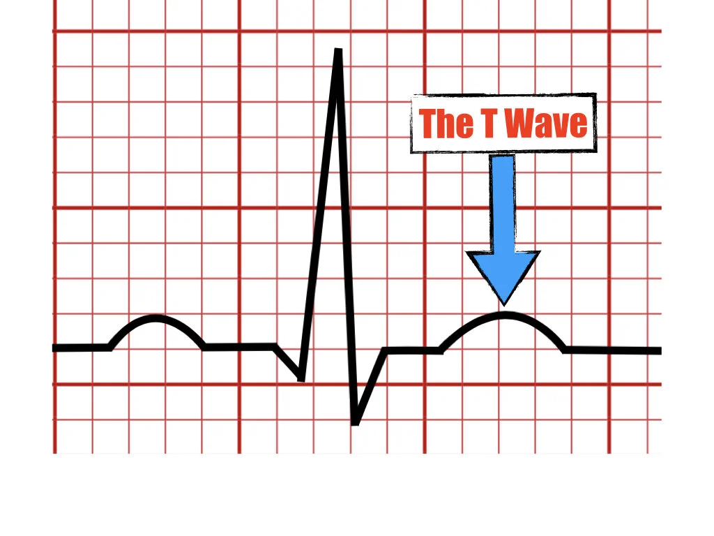 <p>fifth interval</p><p>Ventricular repolarization</p>