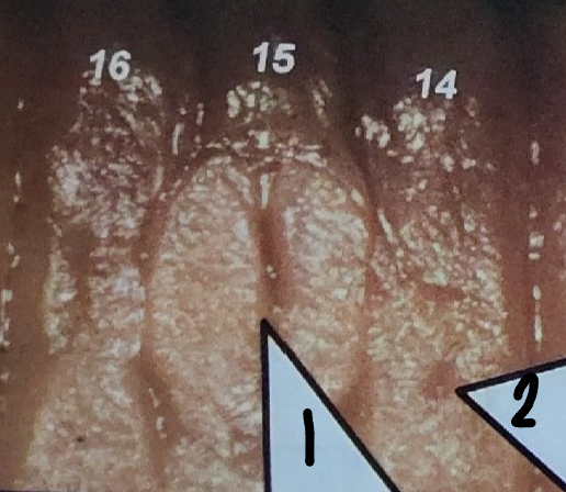 <p>What is point 2 on this earthworm</p>