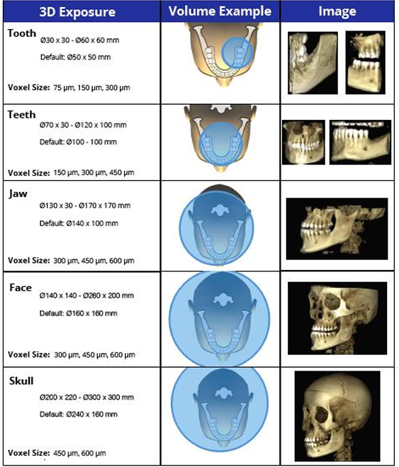 <p>-top one called “limited”: focused or restricted FOV scans providing high-resolution images of limited regions</p><p>-second and third ones “one jaw” or “both jaws”: provide image of the maxilla or mandible or both</p><p>-fourth one “face”: images from the skull base to the chin</p>