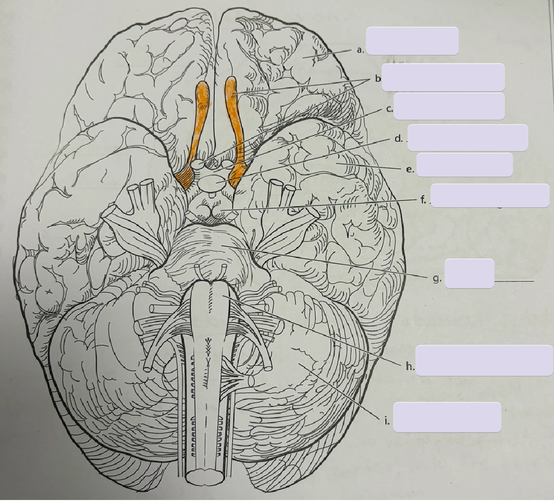 <p>Structure A</p>