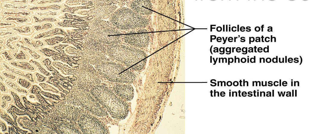 <p><strong>MALT — Peyer's Patches</strong></p><ul><li><p>What are Peyer's patches?</p><ul><li><p>Where are Peyer's patches located?</p></li></ul></li></ul><p></p>