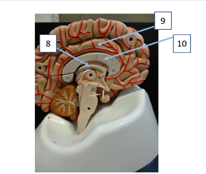 <p>What structure is #9</p>