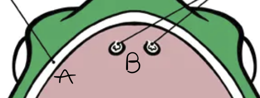 <p>A =</p>