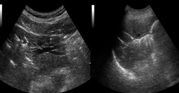 <p>Identify this image. </p>