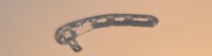 <p>What plate is this</p>